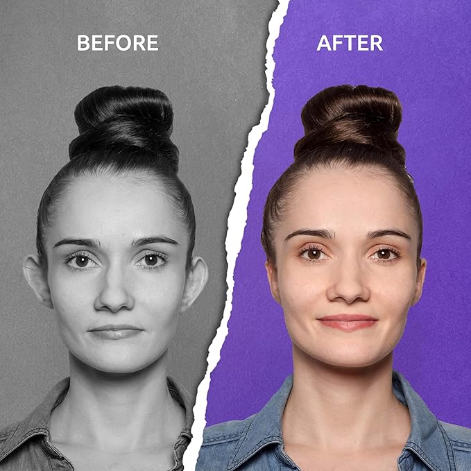 Aureva Ear Lift