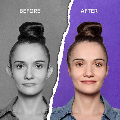Aureva Ear Lift